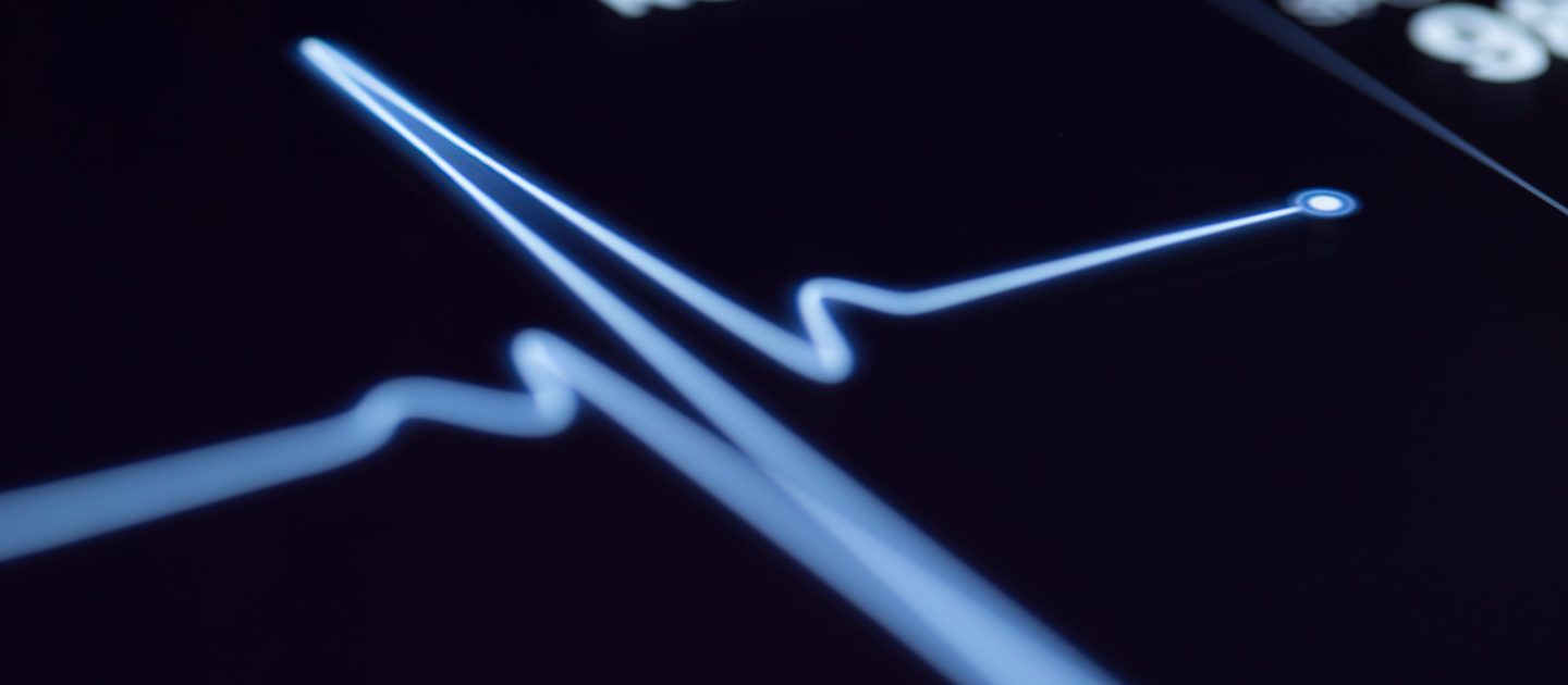 keeping-your-finger-on-the-pulse-of-your-team-part-1-heart-rate-and